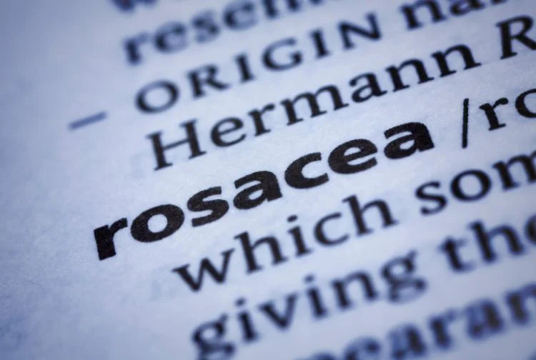 Do I Have Rosacea? How to Recognise the Signs Early
