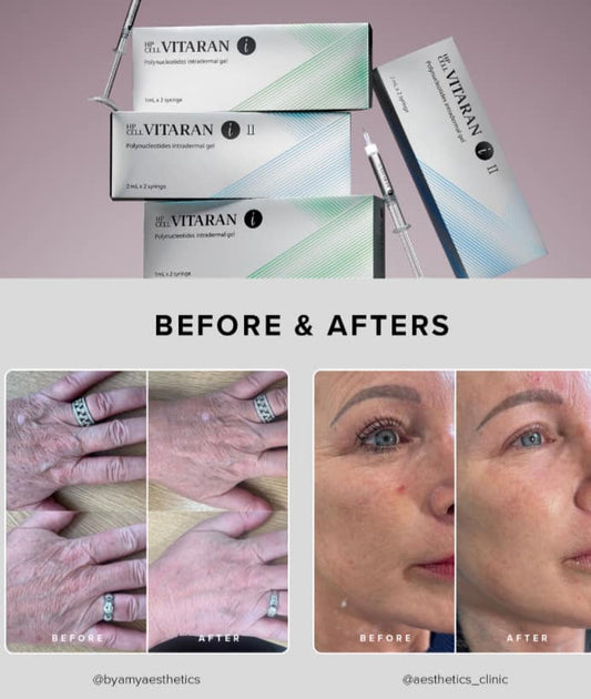 Skin boosters & polynucleotides