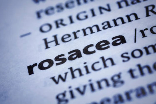 Do I Have Rosacea? How to Recognise the Signs Early