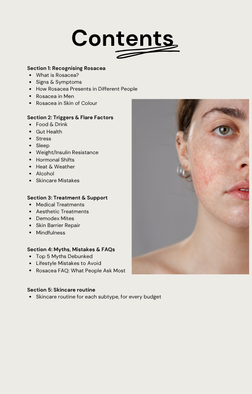 Understanding Rosacea: A 21-Day Awareness Guide
