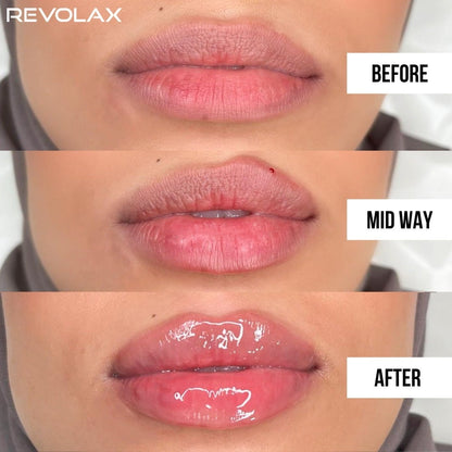 Face & Lip fillers