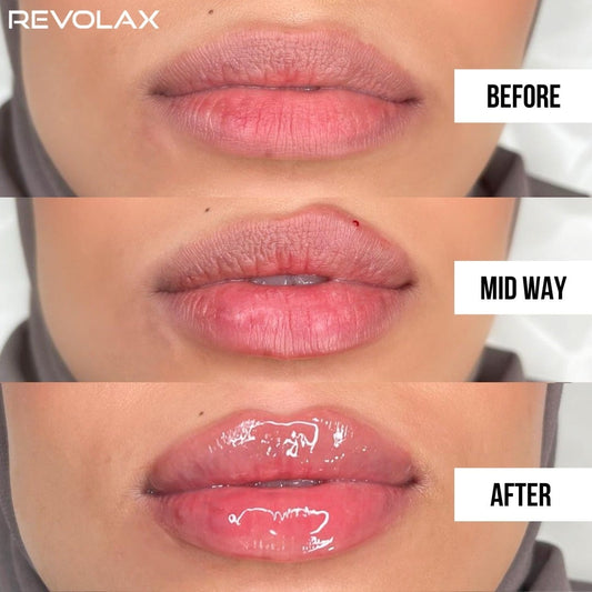 Face & Lip fillers