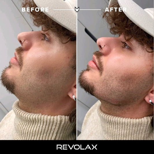 Face & Lip fillers