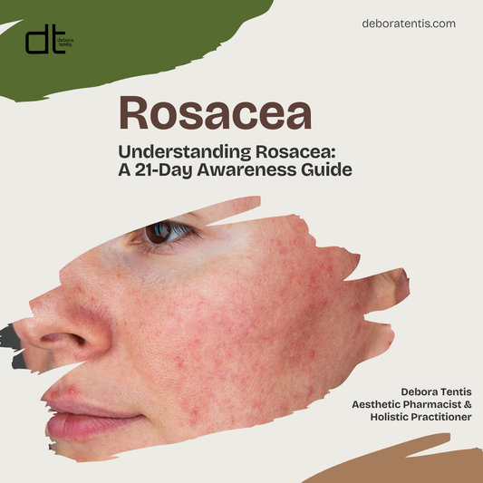 Understanding Rosacea: A 21-Day Awareness Guide